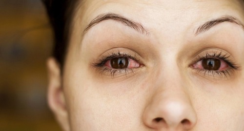 Nguyên nhân của khô mắt là gì?